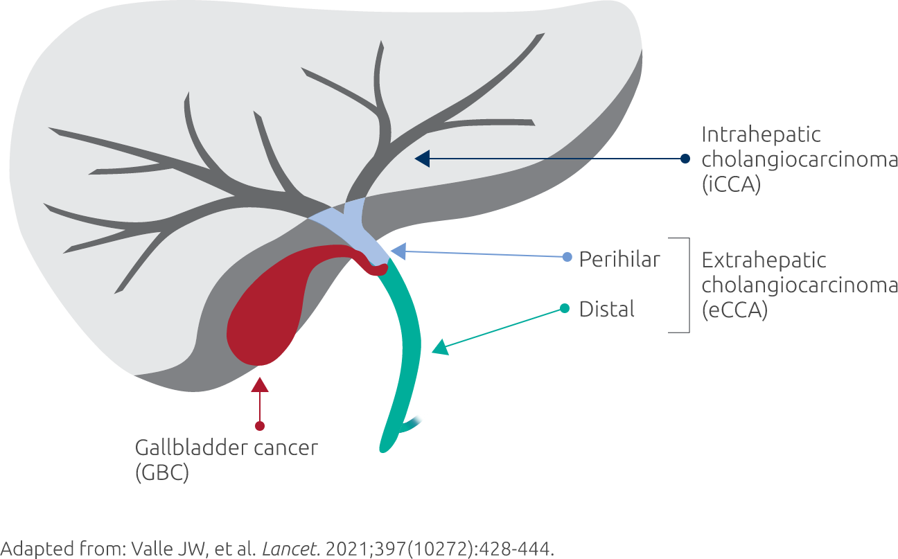 BTCs by anatomical site of origin graphic