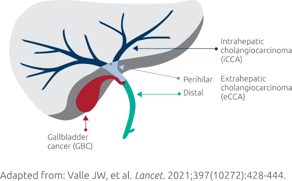 BTCs by anatomical site of origin graphic